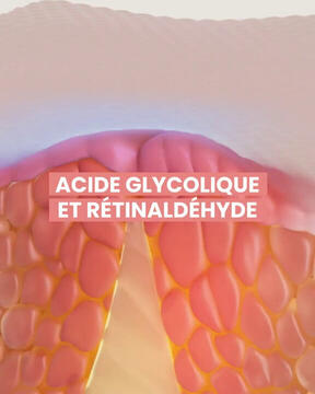 Avène - Cleanance Comedomed Peeling Intensif Anti-Boutons