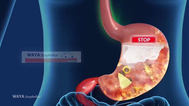 WAYA StopReflux® Für Erwachsene und Jugendliche ab 12 Jahren