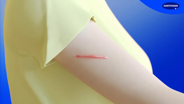 HARTMANN cosmos® Narbenpflaster