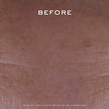 Nuxe Crema Anti-Macchie E Anti-Età SPF30 50ml