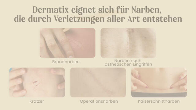 Dermatix Ultra Gel